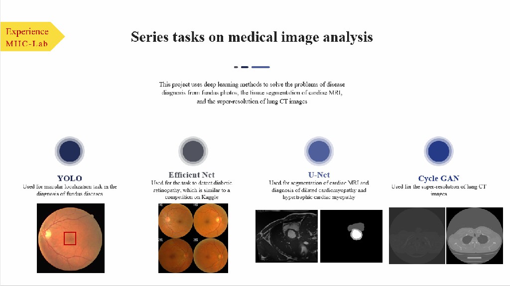 Medical Image processing Polarispw's homepage